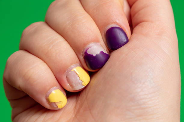 Damaged nail polish of purple and yellow color on the nails of the hand. Green background with space for text. Close-up. Selective focus. stock photo