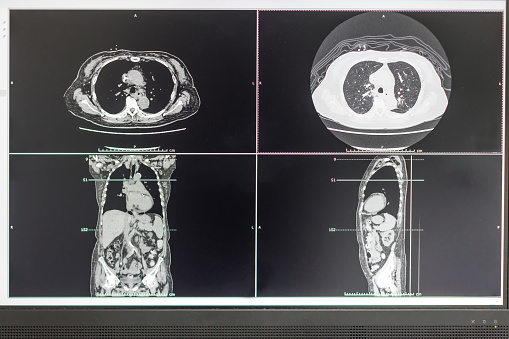 Computer Screen Showing MRI, CT Image Scan of the Brain. CT whole abdomen. Computer tomography scans in motion of lower and middle abdominal body area