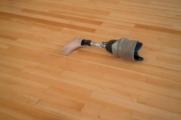 istock Prosthetic limb lying on volleyball court 1319965204