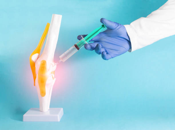 the doctor makes a therapeutic injection into the mock knee joint with corticosteroid and ozone. concept for the treatment of knee joints using injection blockade. blue background, copy space for text - osteoarthritis doctor medicine healthcare and medicine imagens e fotografias de stock