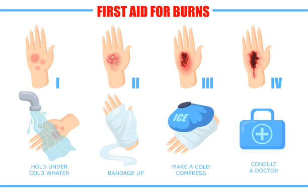 illustrazioni stock, clip art, cartoni animati e icone di tendenza di modi per guarire diverse lesioni da ustione cutanea - second skin