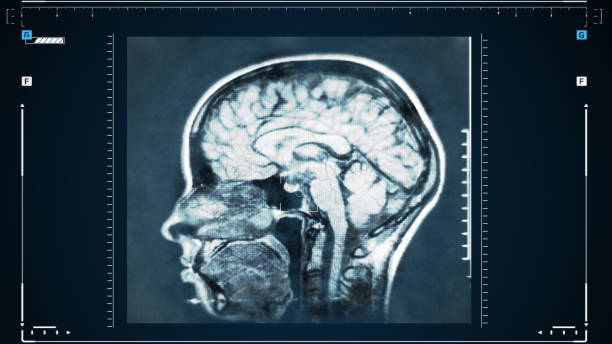 animation de visualisation de balayage cérébral. équipement médical spécial pour les tests tumoraux. test de neurologie. rayon x. outil médical diagnostique. - mri scan diagnostic medical tool radiologist x ray image photos et images de collection