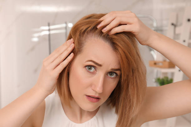 istock Sad woman suffering from baldness at home 1320295838
