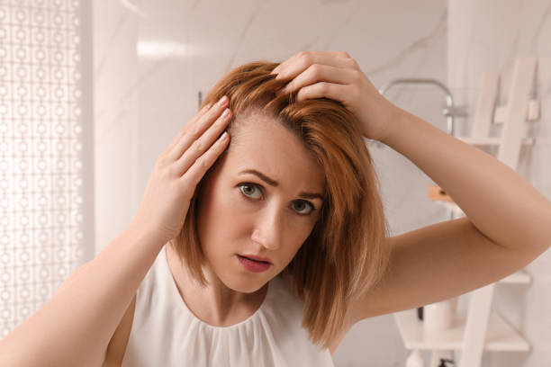 istock Sad woman suffering from baldness at home 1320296796