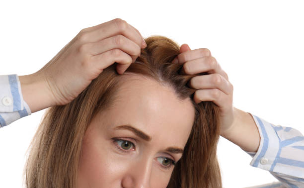 istock Woman suffering from baldness on white background, closeup 1320297079