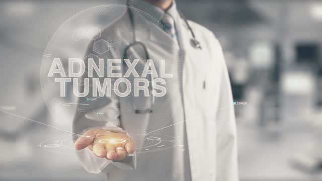 Doctor holding in hand Adnexal Tumors