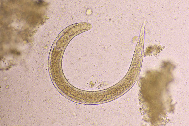 istock Strongyloides stercoralis or threadworm in human stool 1320344144