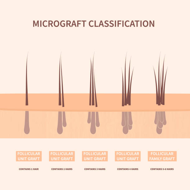 103 Hair Follicle Diagram Cartoon Illustrations & Clip Art - iStock