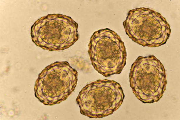 istock Egg of Ascaris lumbricoides in human stool 1320345560