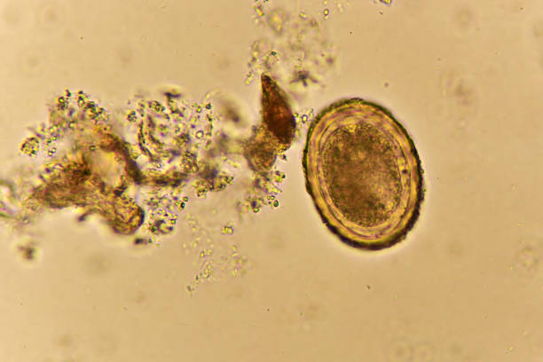 istock Egg of Ascaris lumbricoides in human stool 1320345561