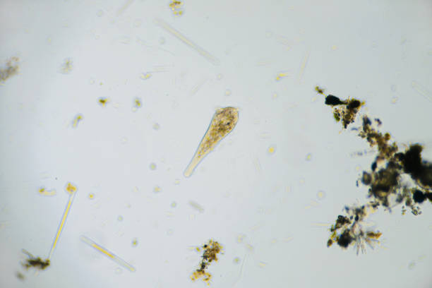 istock Ciliates Stentor found in freshwater pond under the light microscope 1320388281