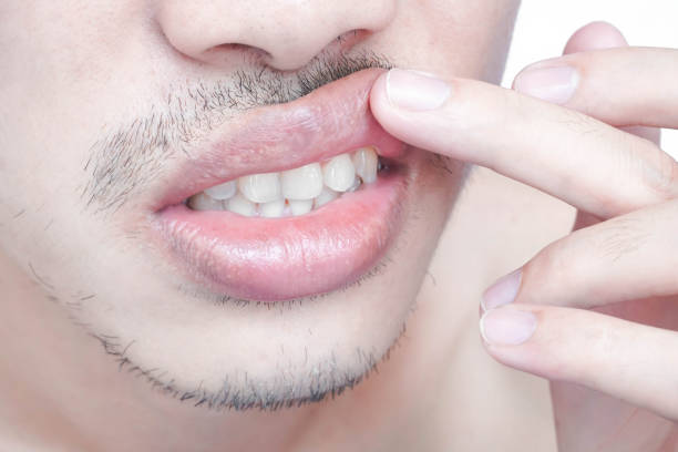 istock Closeup lips man upper and lower with reduction surgery, beauty concept 1320429579