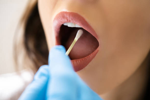 istock Mouth Swab DNA Test For Disease 1320665103