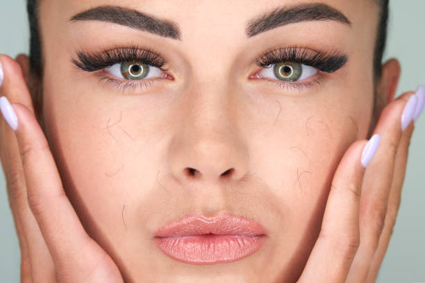istock Woman with artificial eyelash loss problem. Fallen eyelashes all over the face 1320774557