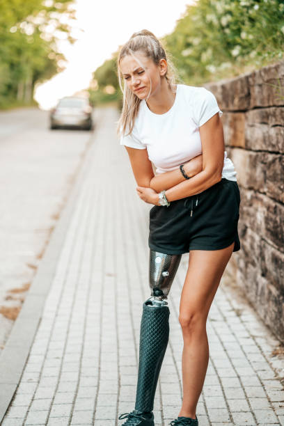 istock Young woman with prosthetic leg exercise outdoors 1320796806