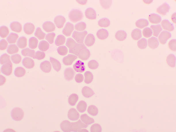 malaria parasite in red blood cells - malaria imagens e fotografias de stock