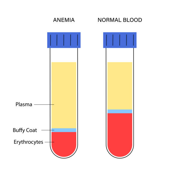 Bhc Normal 150+ Normal Red Blood Cells Illustrations, Royalty-Free Vector Graphics ...