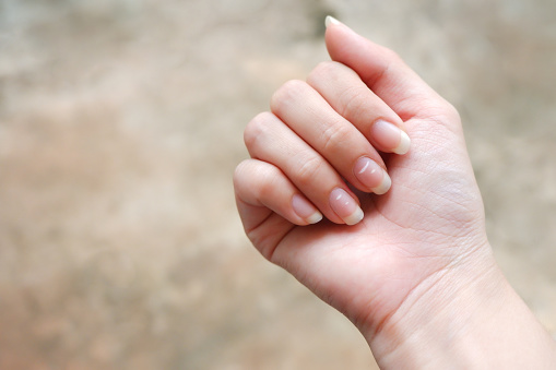Mancha blanca en la uña de la mujer, Revelado sobre la salud causada por la deficiencia de calcio. Esta enfermedad se llama leucoquia. photo