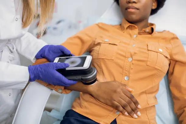 Preventive checkup, skin melanoma days concept. Close up of hands of female doctor dermatologist oncologist holding new generation dermatoscope, examining birthmarks and moles of afro lady