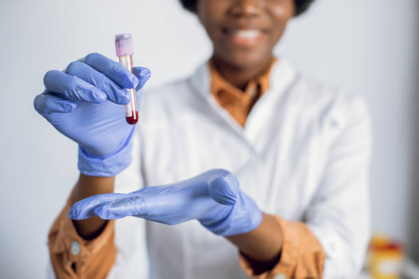 tubo de teste de sangue nas mãos de uma mulher. de perto, vista turva da simpática assistente de laboratório afro-americana ou cientista com luvas azuis, segurando um tubo de ensaio com amostra de sangue. pandemia da covid-19. - hiv cell human cell retrovirus - fotografias e filmes do acervo