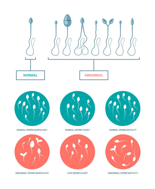 spermogramm. medizinische infografik mit gesunden und beschädigten spermatozoen-geburtsplan-ovulationsprozessen grish vektor flache schablonen - zählen grafiken stock-grafiken, -clipart, -cartoons und -symbole