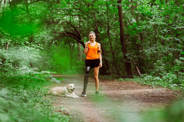 istock Young woman with prosthetic leg exercise outdoors 1321136657