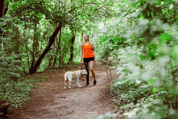 istock Young woman with prosthetic leg exercise outdoors 1321141003