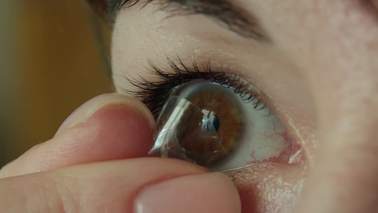 Woman with brown eyes removes a contact lens on her eye with her fingers, close-up