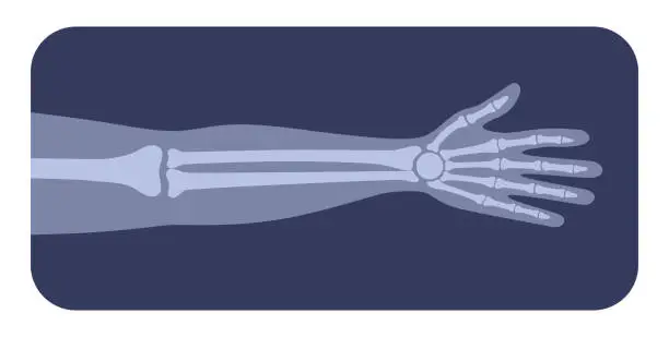 Vector illustration of Arm bones poster