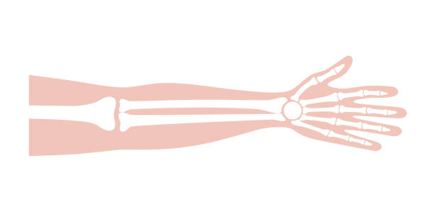 ilustrações, clipart, desenhos animados e ícones de pôster de ossos de braço - braço à volta