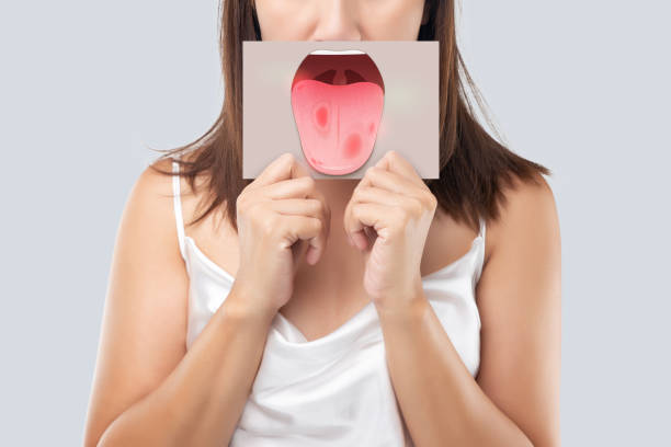 The woman show the picture of tongue problems stock photo