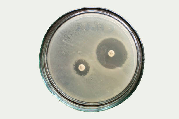 Extended spectrum beta lactamases of E coli bacteria on petri dish stock photo