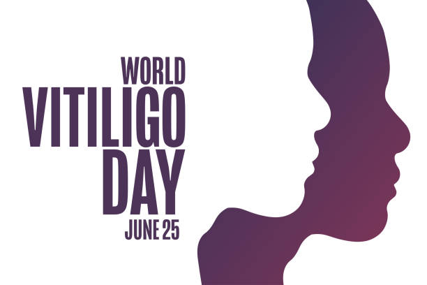 World Vitiligo Day. June 25. Holiday concept. Template for background, banner, card, poster with text inscription. Vector EPS10 illustration. World Vitiligo Day. June 25. Holiday concept. Template for background, banner, card, poster with text inscription. Vector EPS10 illustration vitiligo stock illustrations