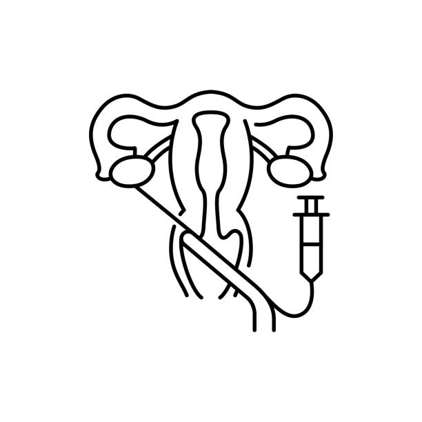 ilustrações, clipart, desenhos animados e ícones de ícone da linha olor de recuperação de oólitos transvaginal. gravidez. pictograma para página web, aplicativo móvel, promo. - retrieval