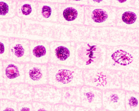 Light micrograph showing mitosis in root meristem onion cells. At the centre is one cell in metaphase, with chromosomes along the metaphase plate and mitotic spindle fibres. At right, one prophase.