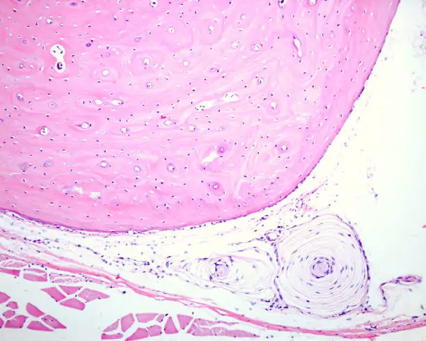Pacinian corpuscles are mecanoreceptors frequent in deep dermis but also in other locations such as the bone periosteum, joint capsules, pancreas and other viscera, breast, and genitals. This light micrograph shows a cross-sectioned Pacinian corpuscle located in the bone periosteum.