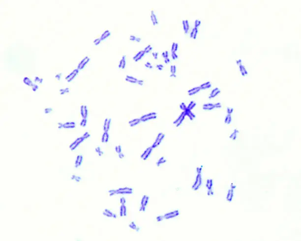 Photo of Human karyotype