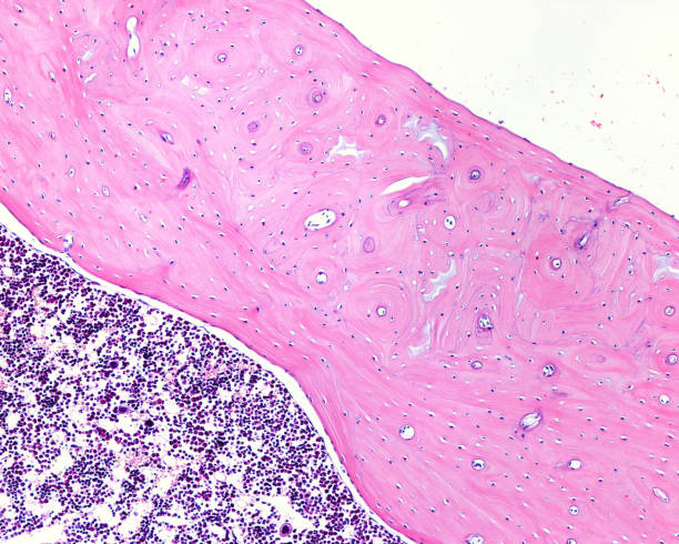 hueso cortical - sistema de havers fotografías e imágenes de stock