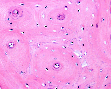 Compact cortical zone of a small bone. The round structures are osteons or Haversian systems, separated by osteon remnants called interstitial lamellae. Cement lines can be seen at the boundary of these structures.