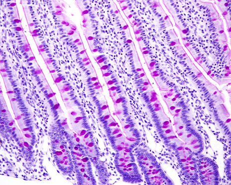 Vellosidades intestinales. Células caliciformes photo