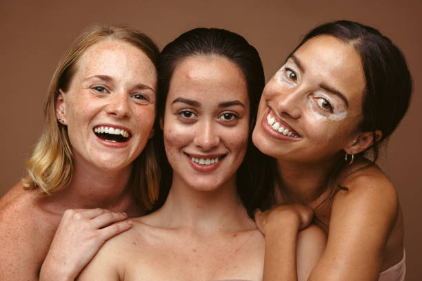 istock You are beautiful when you appreciate your flaws 1321678662