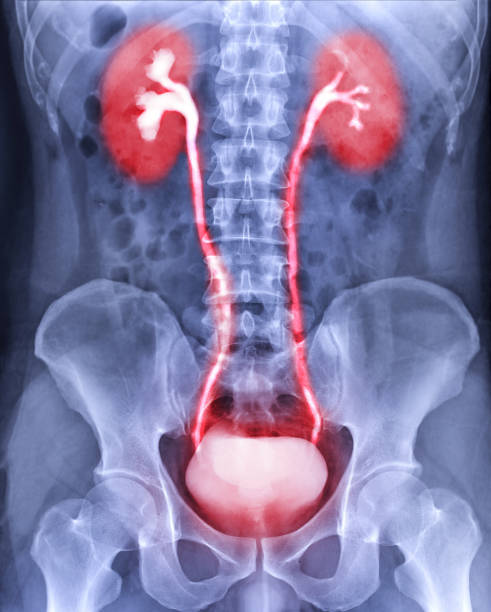 Intravenous pyelogram or I.V.P showing  of urinary tract after injection contrast media agent 25 minute. Intravenous pyelogram or I.V.P showing  of urinary tract after injection contrast media agent 25 minute. medical diagram photos stock pictures, royalty-free photos & images