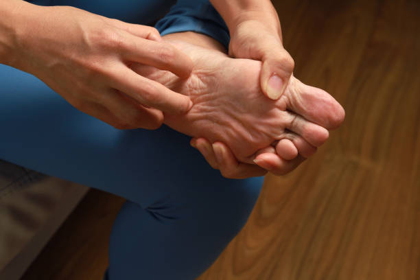 Low Section Of Woman Scratching Foot, Athlete foot. stock photo