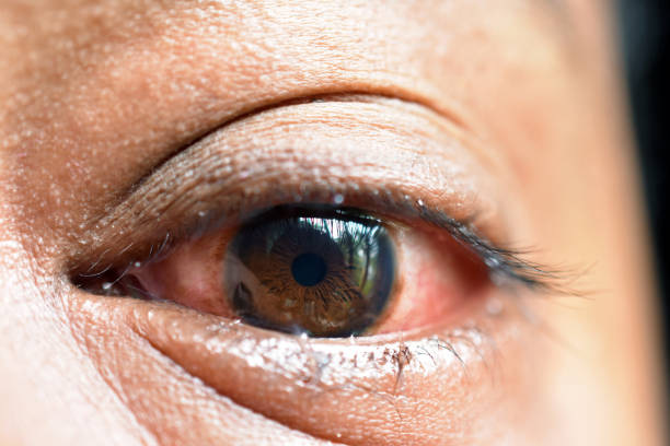istock The human reddish Eye of a sadness 1321957991