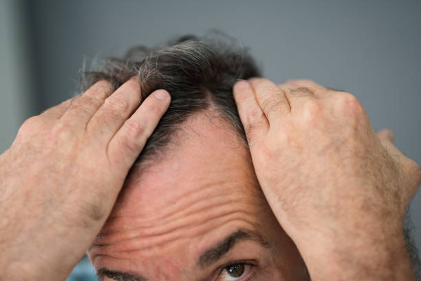 istock Man Checking His Hair Loss 1322051926