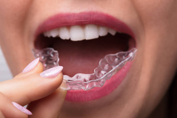 istock Woman Putting Transparent Aligner In Teeth 1322055059