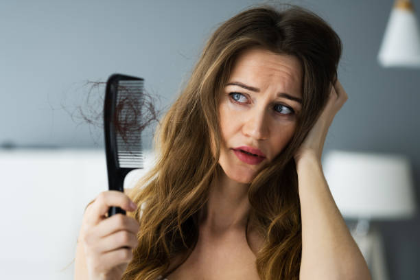 donna che soffre di perdita di capelli - loose hair foto e immagini stock