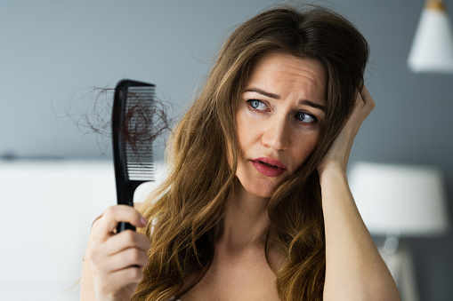 Woman Suffering From Hairloss Or Hairfall Problem
