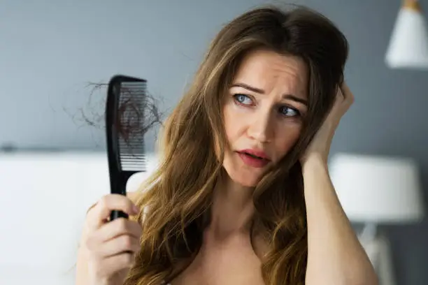 Photo of Woman Suffering From Hairloss