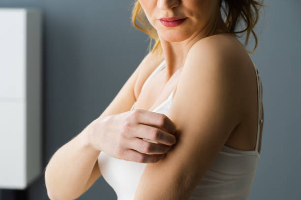 istock Woman Scratching Itching Body Skin 1322057152
